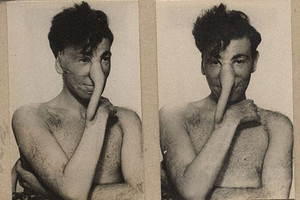 Pamatykite: taip atrodė vienos pirmųjų plastinių operacijų