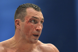 Volodymyro Klyčko stovyklai – kaltinimai noru apnuodyti varžovą