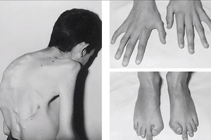 Pamatykite: 10 baisiausių pasaulio ligų