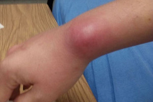 Nešiojate plaukų gumytes ant riešo? Štai kas jums gresia