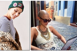 Ketvirtos stadijos vėžys manekenei neužvėrė durų į svajonę