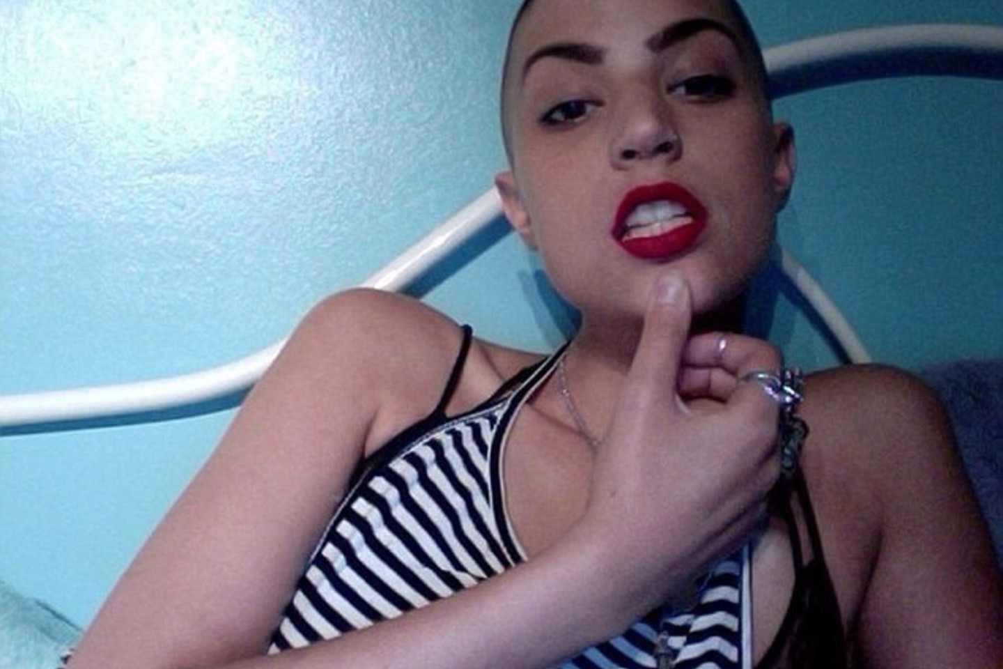 Vėžys jaunai moteriai – ne kliūtis būti modeliu.<br>Asmeninio archyvo nuotr.