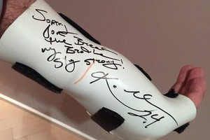 Kobe Bryantas originaliai atsiprašė Jono Valančiūno už lūžį