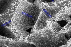 Lietuvių rankose – galimybė visiškai atstatyti žmogaus kaulus