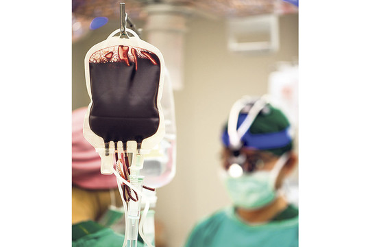 Detektyvinė kraujo maišų viešojo pirkimo istorija