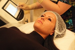 I. Burlinskaitė pripažino – spuogai ją kankina nuo paauglystės