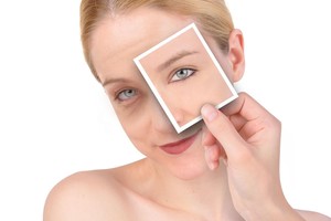 Maišeliai po akimis. 5 būdai, kaip jų atsikratyti