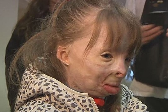 Per gaisrą šeimos netekusi mergaitė Kalėdoms nori tik vieno