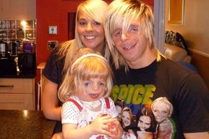 Su iškraipytu veidu gimęs jaunuolis trokšta pakeisti pasaulį