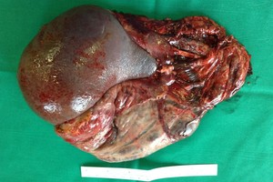 Portugalijoje nesulaukusią pagalbos merginą išgelbėjo vilniečiai