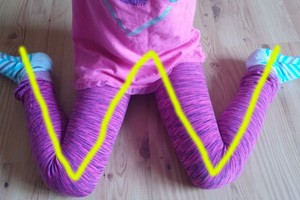 Vaikas mėgsta sėdėti šia poza? Tai labai pavojinga