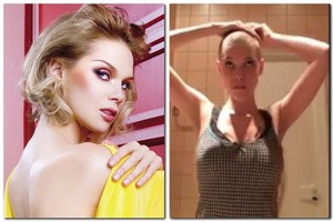 Nusiskutusi plaukus Aistė Paškevičiūtė sulaukė komplimentų