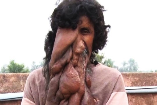 Šokiruojančios išvaizdos elgeta sulaukia išskirtinio dėmesio