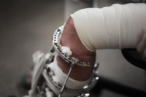 Ką daryti, kad kritimo ant slidaus kelio būtų galima išvengti?