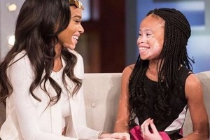 Išpopuliarėjusi Winnie Harlow ant podiumo užkėlė likimo draugę