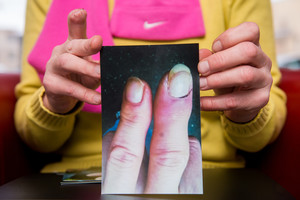 Milžiniškus piršto skausmus kentusi kaunietė ėjo kryžiaus kelius