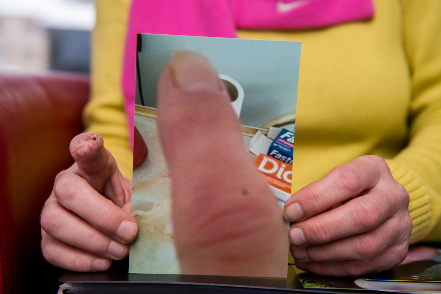 Danutė demonstruoja nuotraukas, kuriose matyti, kaip per metus kito skaudamas pirštas.<br>J.Stacevičiaus nuotr.