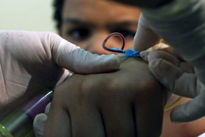 Uodų nešiojamas virusas žudo Brazilijos kūdikius