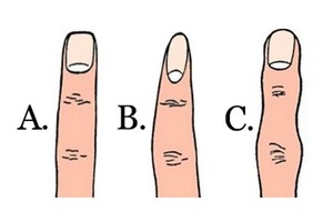 Kokios formos jūsų smilius? Štai ką tai apie jus pasako