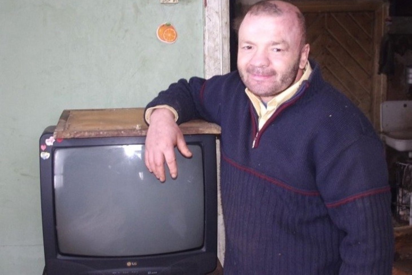 B.Rožėnas ilgai gydėsi kūno nudegimus.