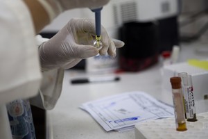 JAV asmuo Zikos virusu užsikrėtė per lytinius santykius