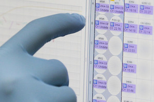 Du lietuviai tiriami dėl Zika viruso