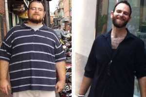 Vyras atsikratė 73 kilogramų nesilaikydamas jokios dietos