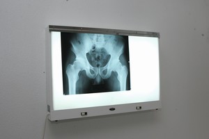 Už netyčinį atradimą – pirmoji Nobelio fizikos premija