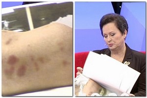 Vaikų gydytoja: „Motina mažyliui išmušė visus dantis“