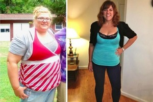 Motyvuoja: neįtikėtini kūno svorio pasikeitimai