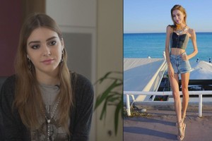 Sukrečianti lietuvės kova su anoreksija nejaudino darbdavių