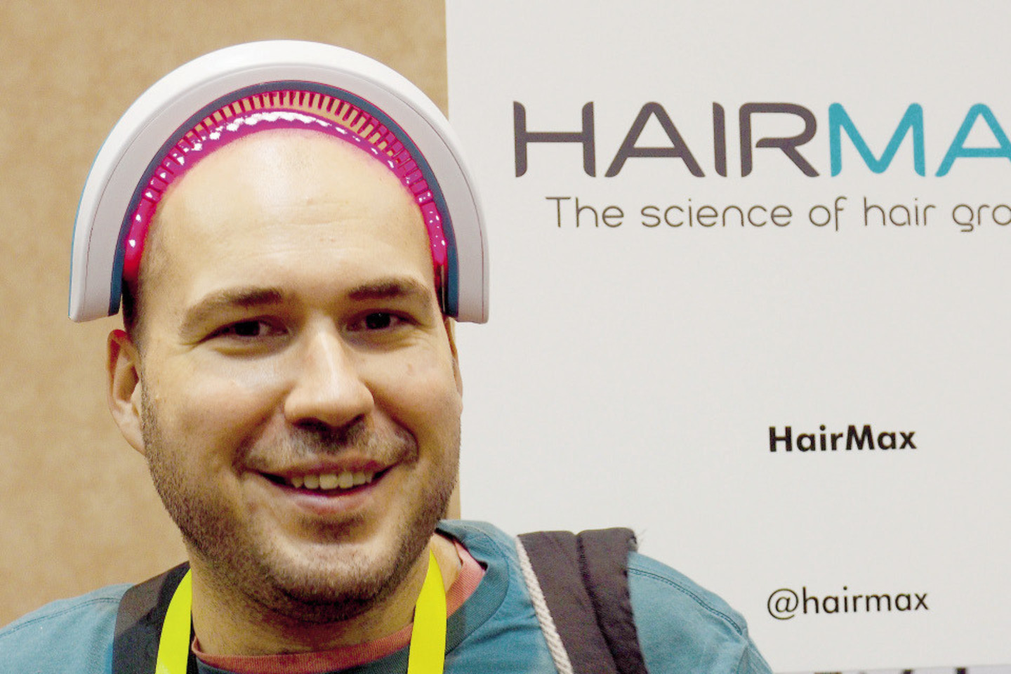 „HairMax“ tvirtina, kad šis lankelis su 82 medicininiais lazeriais net 90 proc. atvejų padidina plaukų tankį ir juos sutvirtina.