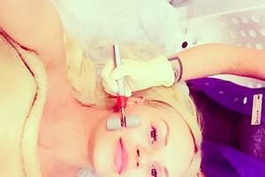 Besilaukianti Vita Pliadytė nepamiršta rimtų grožio procedūrų