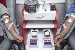 Geležies trūkumo pasekmės organizme – siaubingos