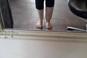 Dramblialigės istorija: jauna kelmiškė nežinojo, kas jos laukia