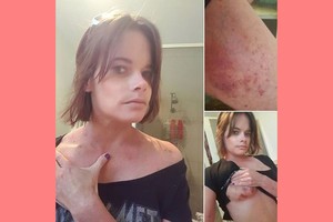 Žiauri pamoka: moteris parodė internetinės pažinties pasekmes