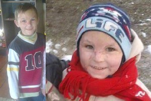 Berniukas liepsnų sudarkytu veidu nori gyventi be užgauliojimų