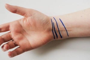 Ar turite ant riešo šias linijas? Tai parodo svarbų dalyką