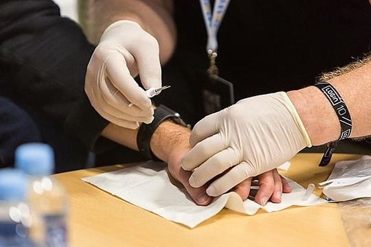 Įamžino: pirmajam lietuviui įdiegė mikroschemą rankoje