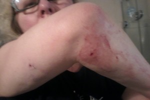 Paksų šeimai – nemalonumai dėl užpuolimo parke