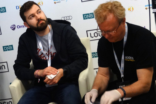 Pirmasis lietuvis su įdiegta mikroschema rankoje