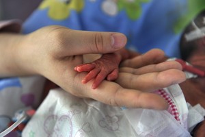 Berniukas dėl šokiruojančios nuotraukos išgarsėjo dar negimęs