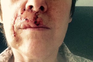 Deginimuisi naudojate aliejų? Štai kodėl tai – prastas sumanymas