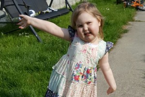 Atliktas tyrimas parodė trimetės Evos smegenų auglio pokyčius