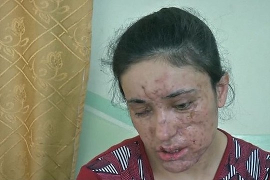 Iš islamistų vergovės pasprukusi moteris – apie patirtą košmarą