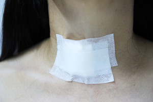 Pašalinus šį svarbų organą laukia dideli gyvenimo pokyčiai