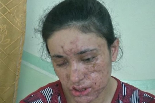 Iš islamistų vergovės pasprukusi moteris – apie patirtą košmarą