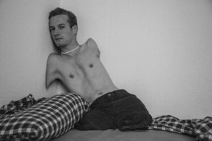 Berankis ir bekojis vokietis stengiasi patirti gyvenimo pilnatvę