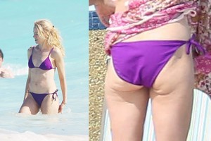 Celiulitas neaplenkia ir Holivudo gražuolių. Kaip su juo kovoti?