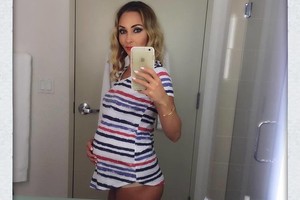 Nėščia buvusi „Žuvėdros“ šokėja I. Lukošiūtė įsiamžino be kelnių